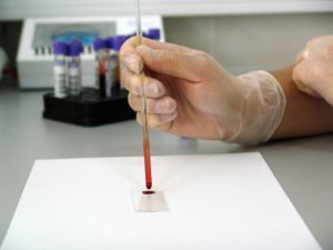 Important Information You Should Consider Regarding Animal Research 3 关于动物研究的重要信息